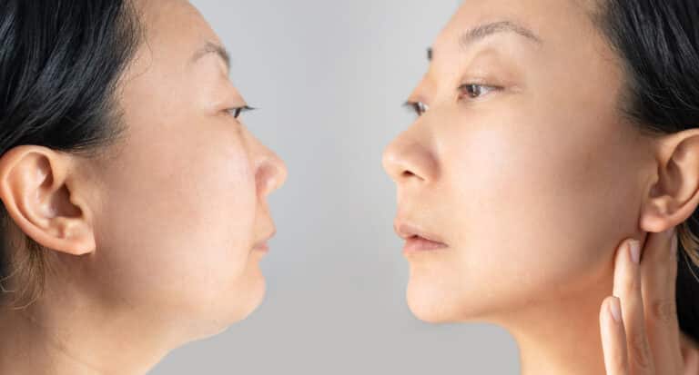 Dites adieu à votre double menton : découvrez 3 techniques infaillibles pour affiner votre visage